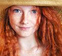 36339_shutterstock_114230827_freckles_red_face.
