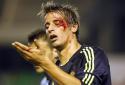 57172_cristiano-ronaldo-595-fabio-coentrao-bleeding-from-his-left-eye-after-picking-an-injury-in-betis-vs-real-madrid-for-la-liga-2012-2013.